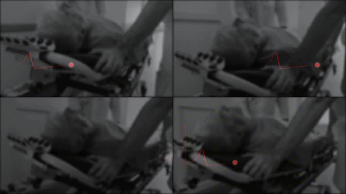 老年人心脏病发作医院抢救心跳心电图 老年人心脏病发作医院抢救心跳心电图